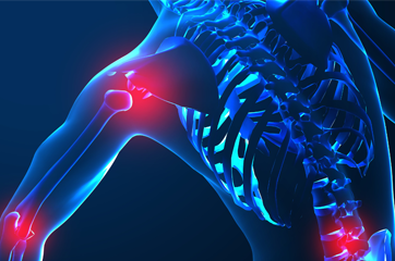 Backache and Joint Pain